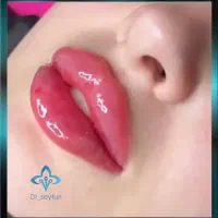 در کلینیک زیبایی ما توسط پزشک باسابقه زیباتر شوید|خدمات آرایشگری و زیبایی|قرچک, مهدیه|دیوار