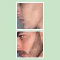 پسر بدون ریش کنسله