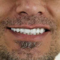 مرکز تخصصی ایمپلنت دیجیتال..|خدمات آرایشگری و زیبایی|تهران, زعفرانیه|دیوار