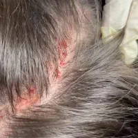 بوتاکس ژل مزوتراپی مو و صورت میکرونیدلینگ فشیال|خدمات آرایشگری و زیبایی|چهارباغ, |دیوار