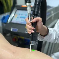 لیزر شاتی دکا ایتالیایی با تست شات رایگان