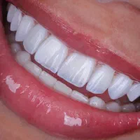 دندانپزشکی،تمام دیجیتال،اقساطی،لابراتوار در مطب