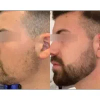 بدون درد و خون ریزی درش میارم