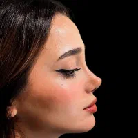 جراحی زیبایی بینی و پیکر تراشی.جشنواره بزرگ ۳۰٪آف|خدمات آرایشگری و زیبایی|تهران, نظامی گنجوی (توانیر)|دیوار
