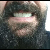 دندان کامل(شرایطی ویژه)|خدمات آرایشگری و زیبایی|سلطانیه, |دیوار