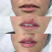 جلسه اول رایگان به مناسبت سالگرد افتتاحیه|خدمات آرایشگری و زیبایی|تبریز, |دیوار