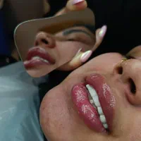 جشنواره دندان ونیر کامپوزیت روکش لمینیت عصب  IMAX|خدمات آرایشگری و زیبایی|تهران, هفت حوض|دیوار