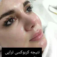 فیشیال صورت آقایان و خانم ها مطب دکترپروین گودرزی|خدمات آرایشگری و زیبایی|یاسوج, |دیوار