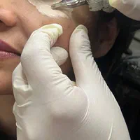 پاکسازی.فیشیال.کاموفلاژ.نیدلینگ .درمان قطعی لک|خدمات آرایشگری و زیبایی|رشت, گلسار|دیوار