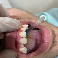 آموزش دوره دستیار کنار دندان پزشک و کامپوزیت