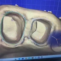 استخدام نیرو دندانسازی