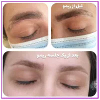 مدل برای پاک کردن تتوی قدیمی ابرو،خط چشم