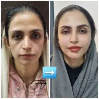 انجام تمامی خدمات زیبایی توسط پزشک زیبایی|خدمات آرایشگری و زیبایی|قم, باغ شازده|دیوار
