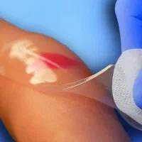 اولین کارشناس تخصصی زخم در کازرون