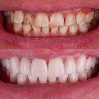 دندانپزشکی تخصصی ایمپلنت دیجیتالی و فوری|خدمات آرایشگری و زیبایی|تبریز, |دیوار