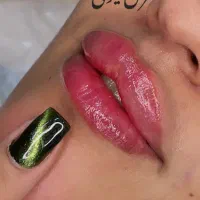 تزریق ژل بوتاکس چربیسوزی آنزیم جوانسازی|خدمات آرایشگری و زیبایی|اهواز, کیانپارس |دیوار