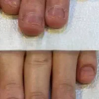 قطع ریزش مو..درمان مشکلات پوستی