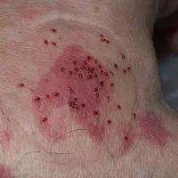 سمپاشی سم پاشی و موریانه زدایی تضمینی تخصصی