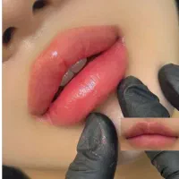 ژل و بوتاکس صورت|خدمات آرایشگری و زیبایی|فولادشهر, مسکن مهر فولادشهر|دیوار