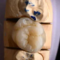 اجاره مجوز لابراتوار دندانسازی