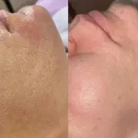 آموزش و خدمات تخصصی فیشیال