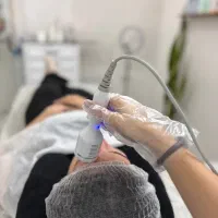 تخفیف نوروزی پاکسازی/فیشال/کربن تراپی/آموزش