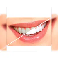 جشنواره بزرگ دندانپزشکی|خدمات آرایشگری و زیبایی|قم, انسجام|دیوار