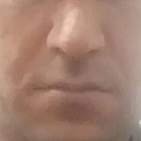 کار های کنتراتی