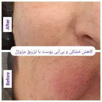 جشنواره مدل و آموزش ژل/ بوتاکس/فیلر بادی در کلینیک|خدمات آرایشگری و زیبایی|شیراز, قدوسی غربی|دیوار