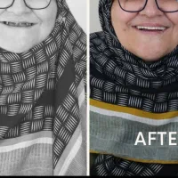 دندانپزشکی شبانه روزی با روکش رایگان فقط 9900