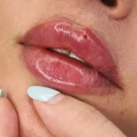 تزریق ژل وبوتاکس