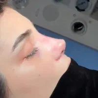 عمل جراحی زیبایی بینی،پلک،لیفت صورت ،اندام