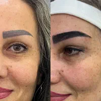 کاشت ابرو دائمی با شرایط ویژه