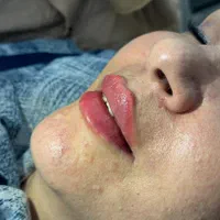 جشنواره تزریق ژل و بوتاکس|خدمات آرایشگری و زیبایی|اصفهان, دانشگاه اصفهان|دیوار