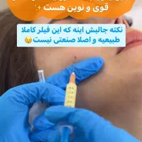 پی آر پی و بایو فیلر با قیمت و جوابدهی عالی