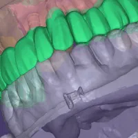 لابراتوار دندانسازی ایمپلنت تخصصی|خدمات آرایشگری و زیبایی|تهران, توحید|دیوار