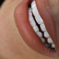 تخفیف ویژه ۲۰٪خدمات دندانپزشکی|خدمات آرایشگری و زیبایی|شیراز, ارم|دیوار