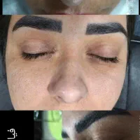 ازببن بردن کک ومک در یک جلسه