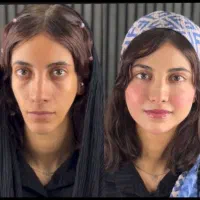 مدل فیلر لب روسی،کانتورینگ صورت،زاویه،چانه وشقیقه