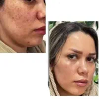 پاکسازی کبد فقط در ۴۰ روز