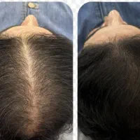 تتو خط چشم دور لب ریمو ابرووخط چشم با۵۰درصد تخفیف|خدمات آرایشگری و زیبایی|میاندوآب, |دیوار