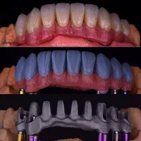 آموزش تخصصی پرسلن دندان(پودرگذاری)