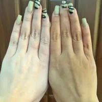 کرم سفید کننده ضدلک وضدجوش اصل سورو