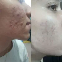 روغن های معجزه گر درمان تمام مشکلات پوست و مو|آرایشی، بهداشتی، درمانی|اندیمشک, |دیوار