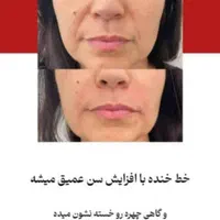 انجام کلیه خدمات تزریق بوتاکس ژل مزو وآنزیم|خدمات آرایشگری و زیبایی|بندر ماهشهر, |دیوار