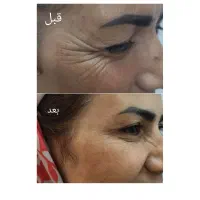 همکاری با لیدر عرب ۵۰ درصد بازاریاب( مشتری یاب)|استخدام درمانی، زیبایی، بهداشتی|مشهد, مصلی (کارمندان اول)|دیوار