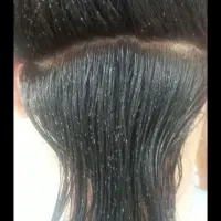 پودرشپش اصلی .تضمینی|آرایشی، بهداشتی، درمانی|جیرفت, |دیوار