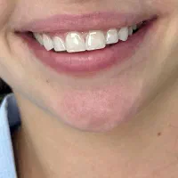 خدمات دندانپزشکی با بهترین متریال و کیفیت