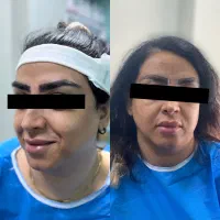 کاشت ابرو فقط با۶ میلیون|خدمات آرایشگری و زیبایی|رشت, گلسار|دیوار