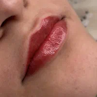 جشنواره ۴۰ درصدی شیدینگ و رفع تیرگی لب